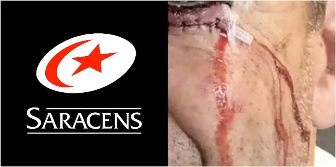 saracens hooker injury