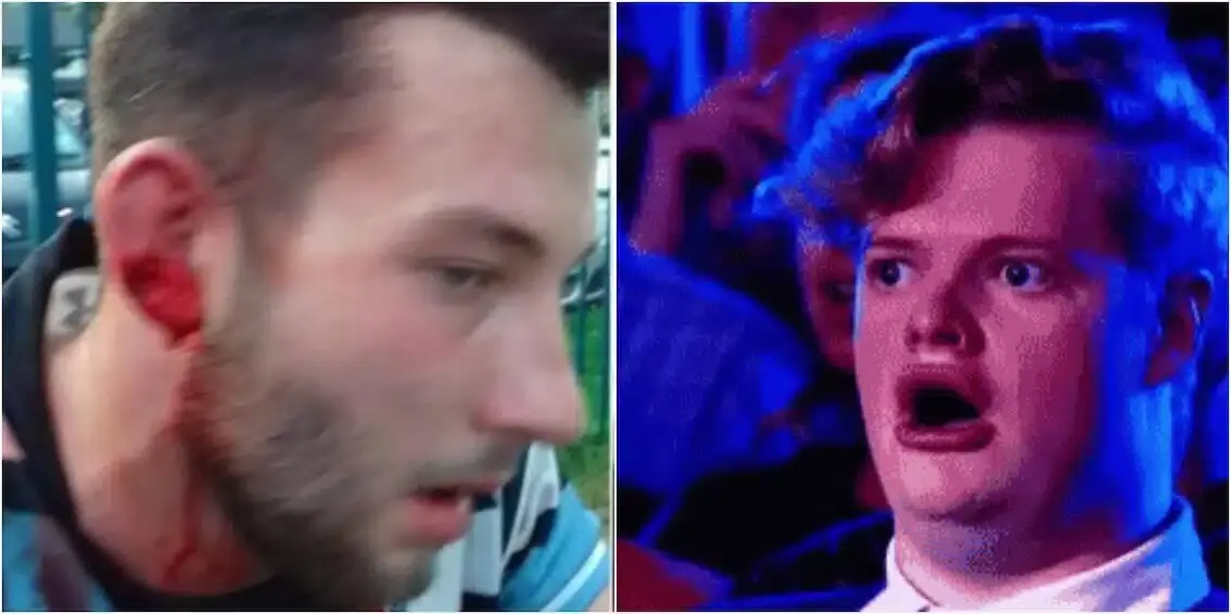 shocked 2