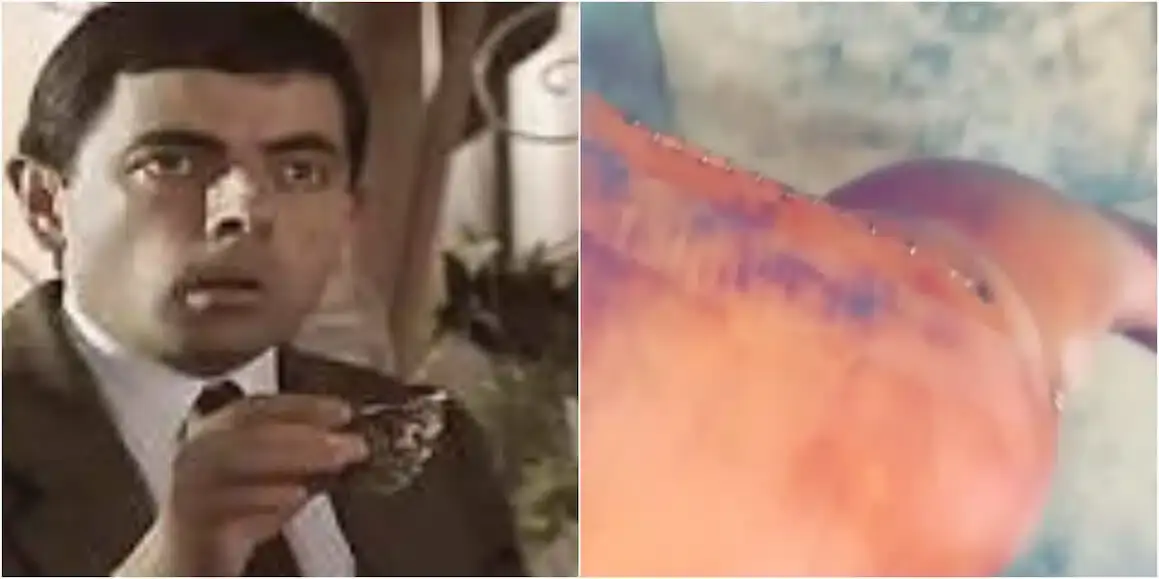 bean 2