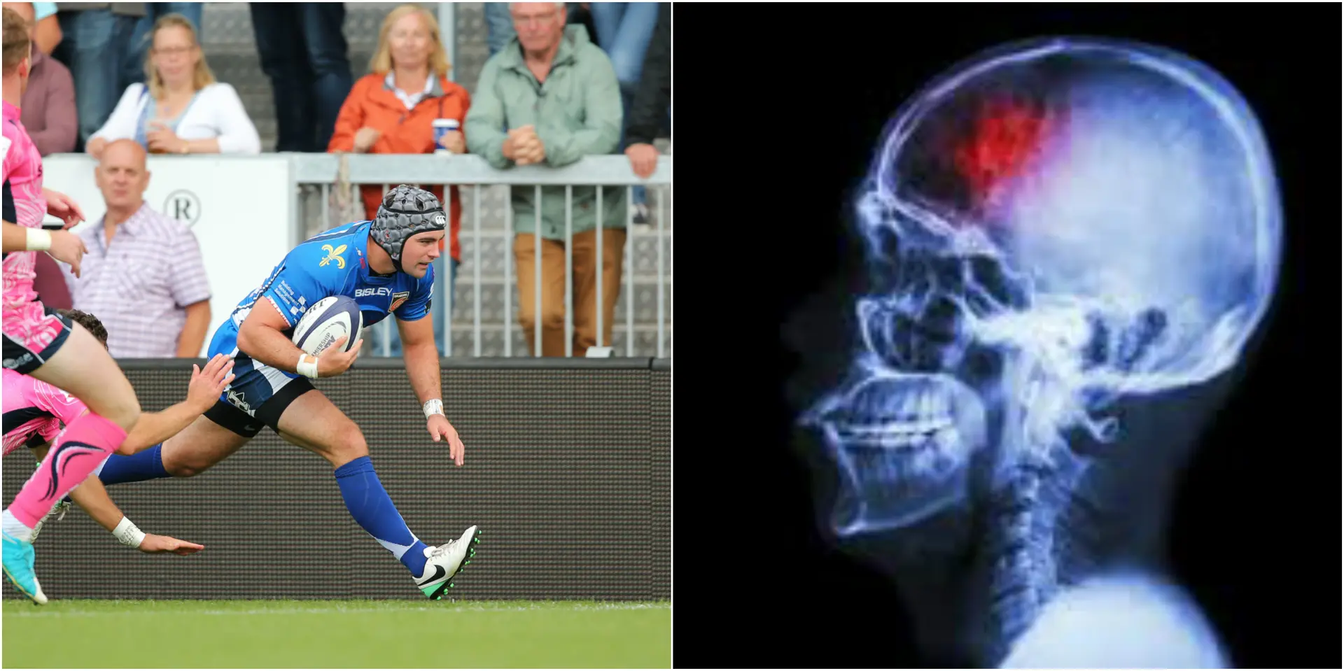 braininjury