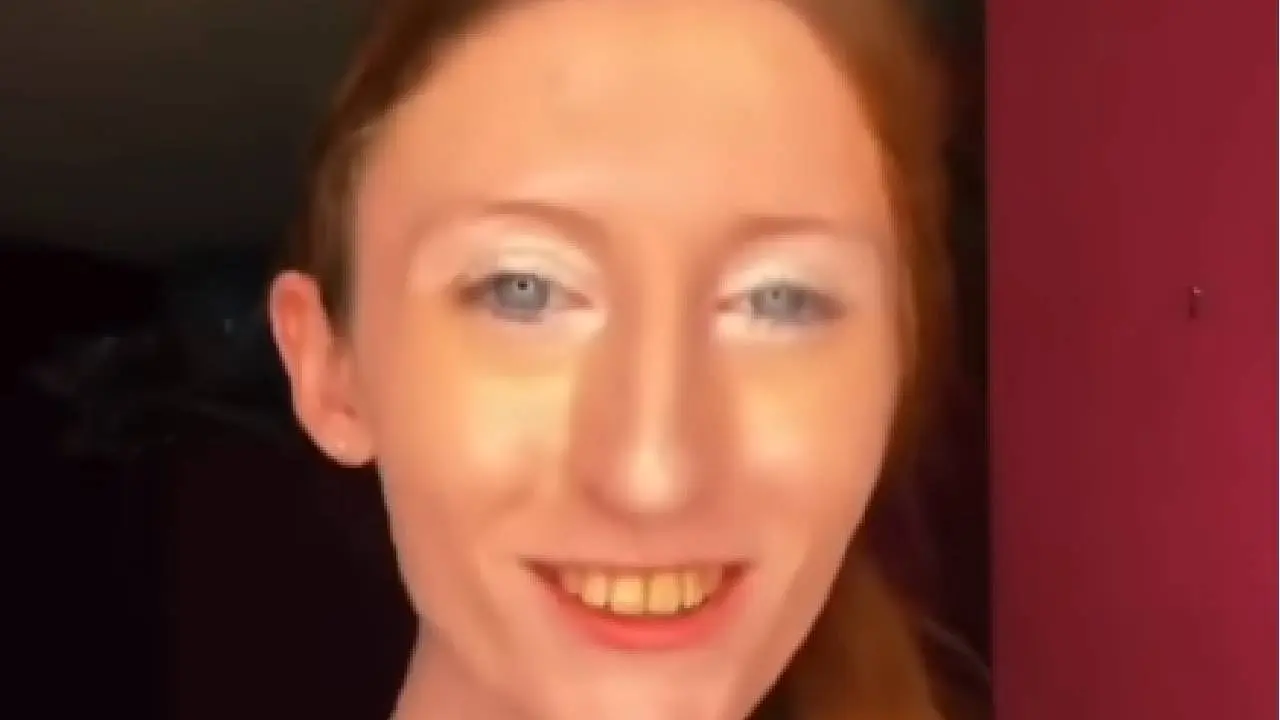 Teeth