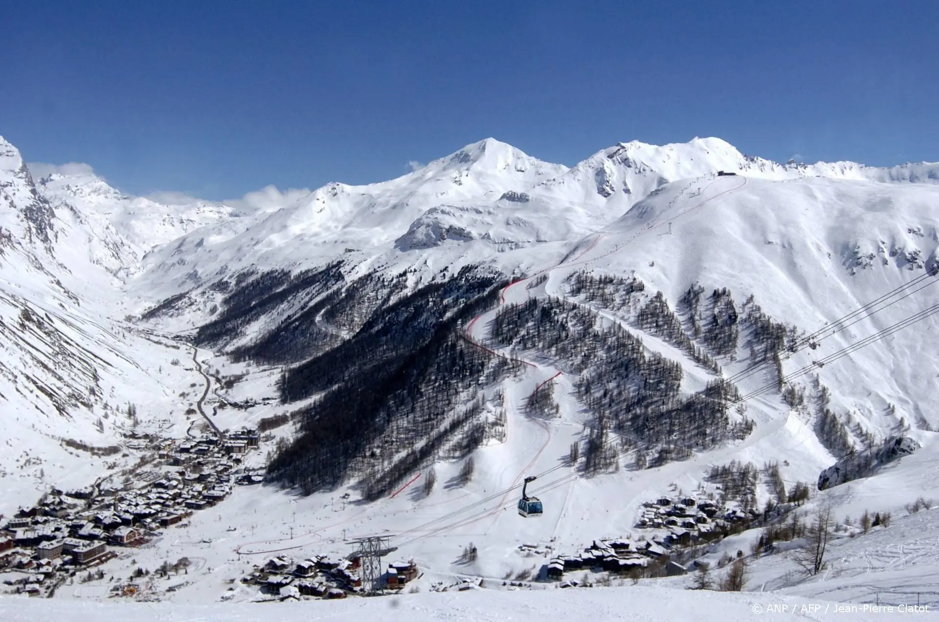 anp100126150 1