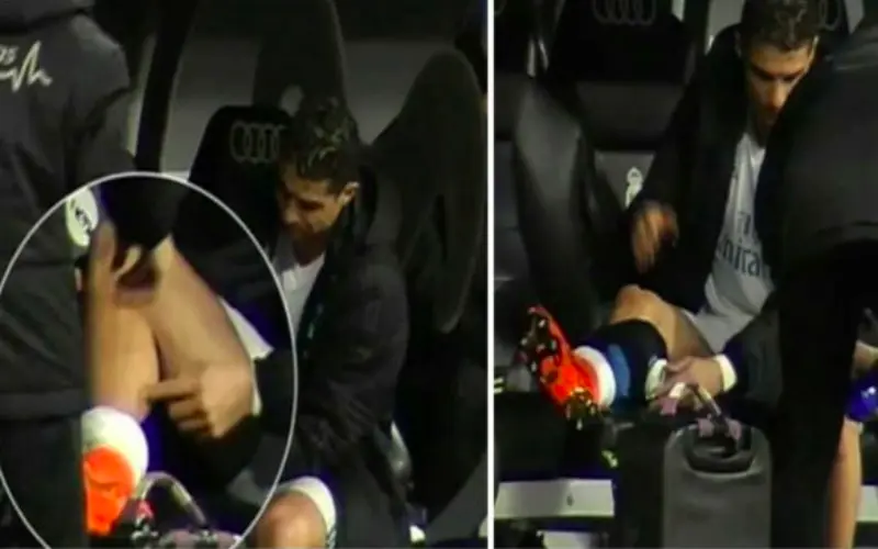 ronaldoblessure