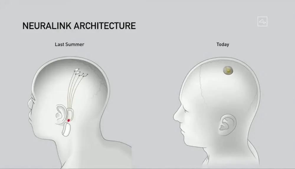 neuralink update elon musk technology dezeen 2364 col 0 852x488