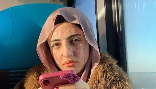 senna vermist2