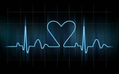 alytausgidas cardiograma1