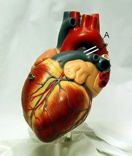 alytausgidas heart frontally pda1
