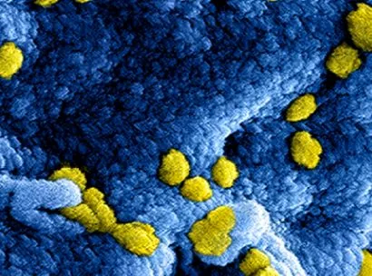 rivmscreenshot 2020 02 28 nieuw coronavirus covid 19