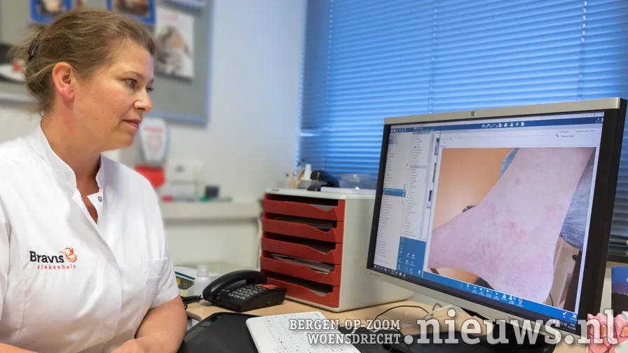bravis dermatologen missen door corona patienten met huidkanker