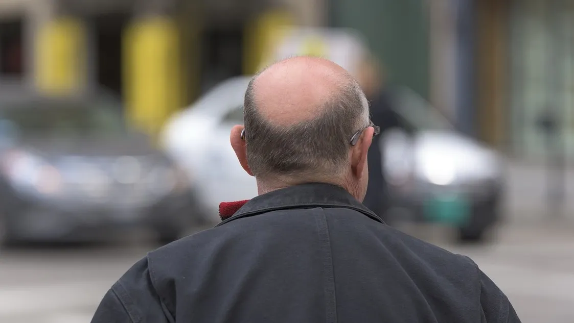 bald 742823 1280 e1443712425822