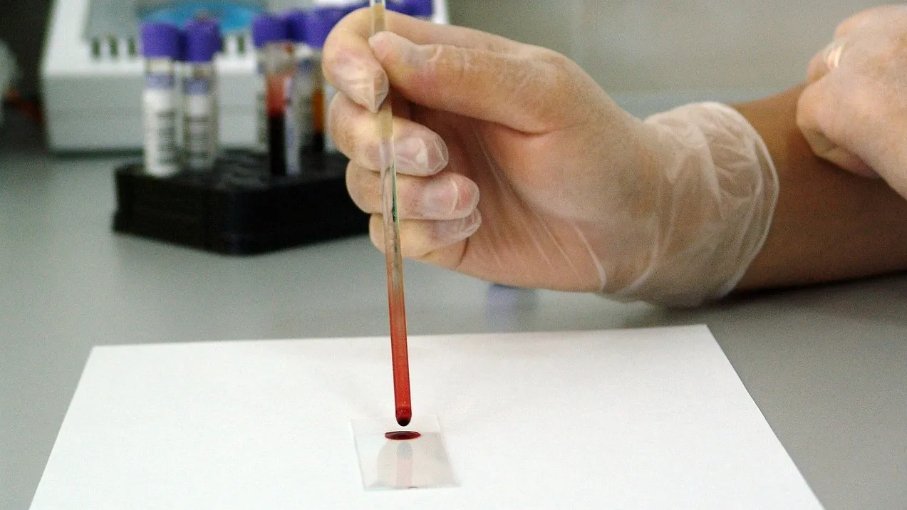 blood 17305 1280 e1433543245472