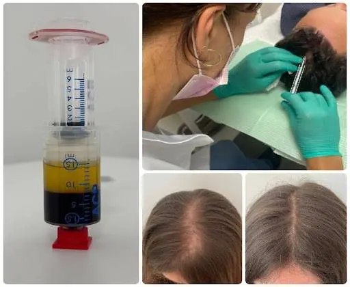 PRP Kasmetics