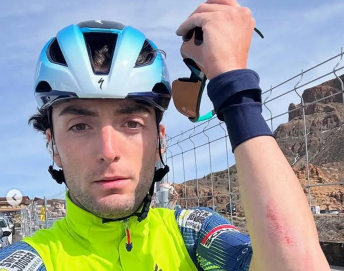 Gianmarco Garofoli of Soudal - Quick-Step shows his wounds after being hit by a high-speed car after a training crash in February 2026