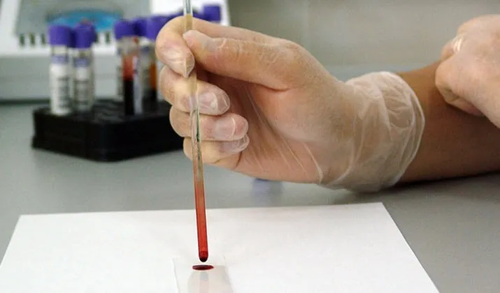 lab
