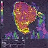 1134420928stralingsbeeld