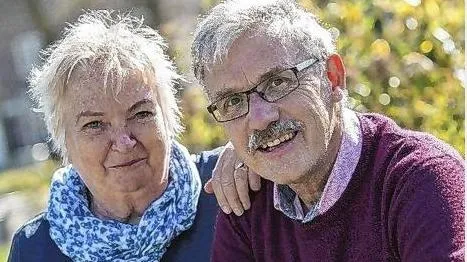 alzheimer
