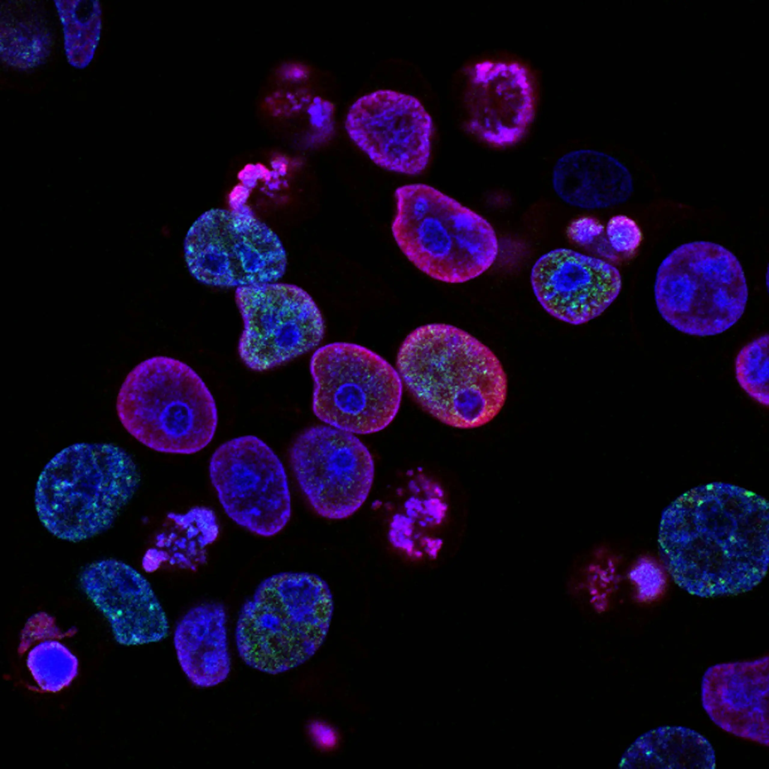 national cancer institute L7en7Lb Ovc unsplash