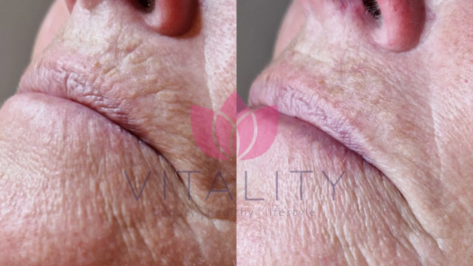 ontwerp zonder titel 1