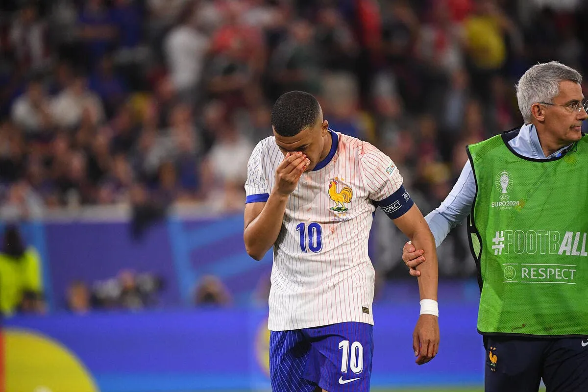 nez casse pour kylian mbappe iconsport 232565 0028 377320