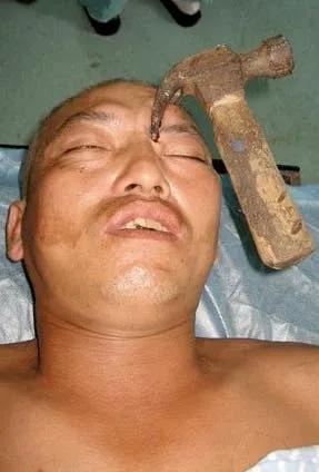 chinese builder hammer in head