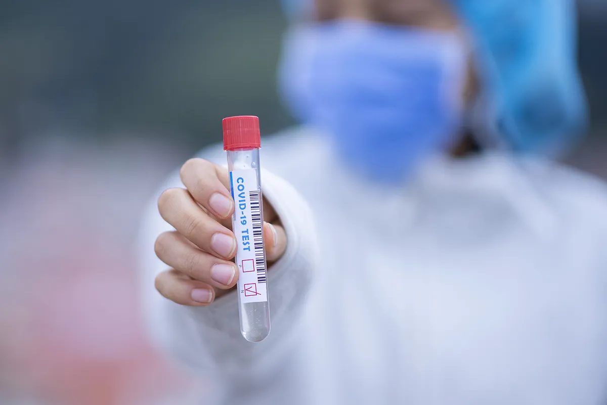 test tube 5065424 1920