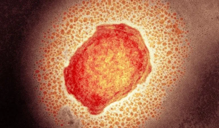 monkeypoxvirus apenpokkenvirus website