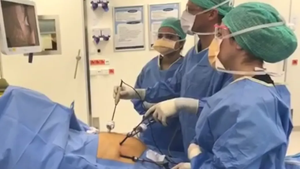 live operatie facebook e1479215473846