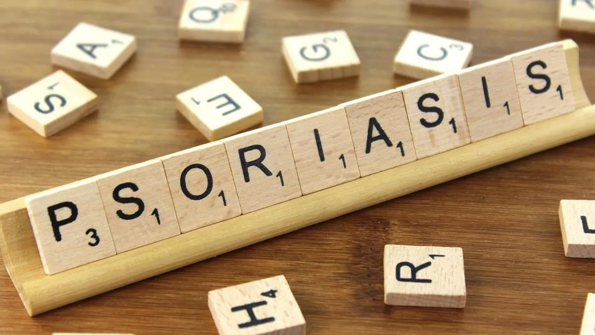 psoriasis e1475431909531