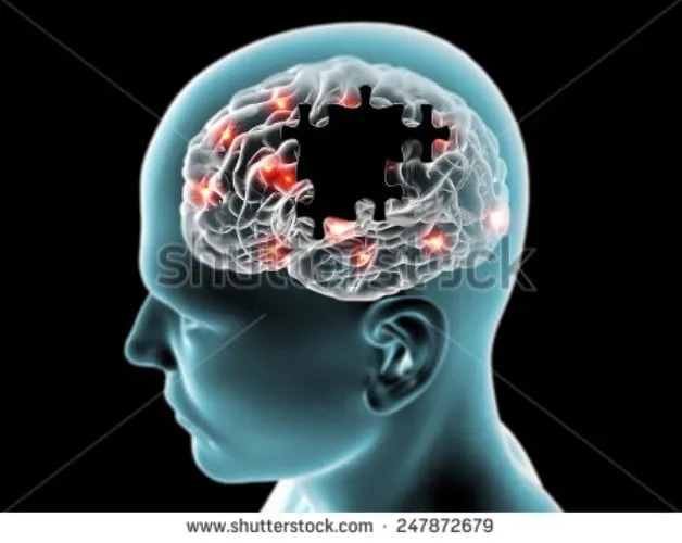 stock photo brain degenerative diseases parkinson alzheimer puzzle 247872679