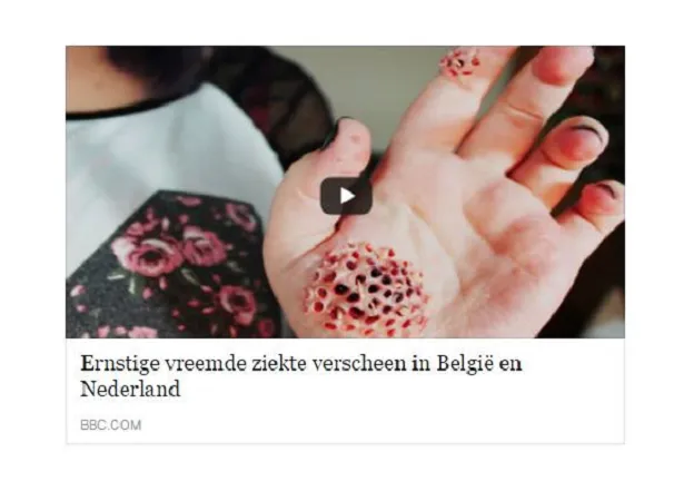 ziekte