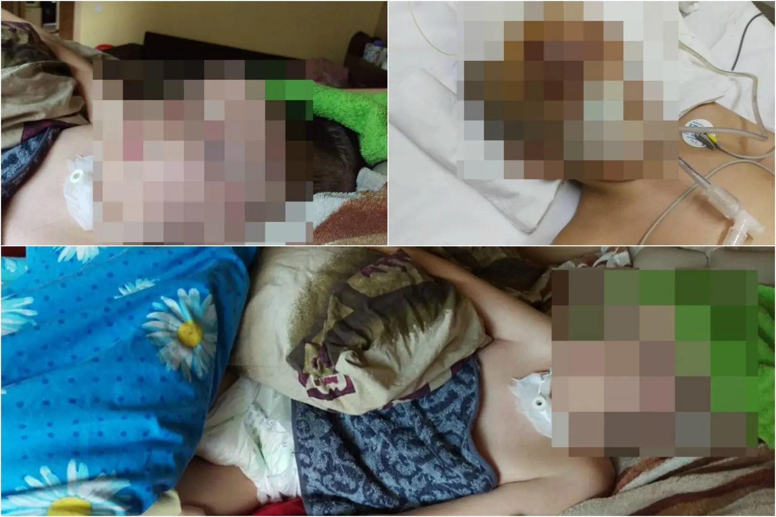 po avarijos nojaus bukle labai sunki 77473987