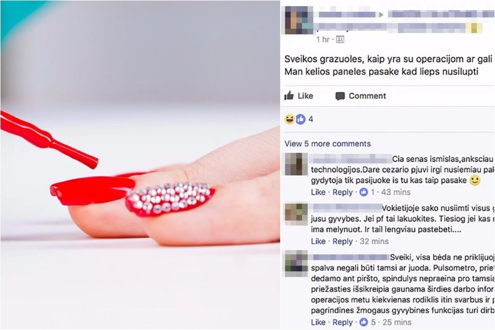 Lakuoti nagai ir ligoninė