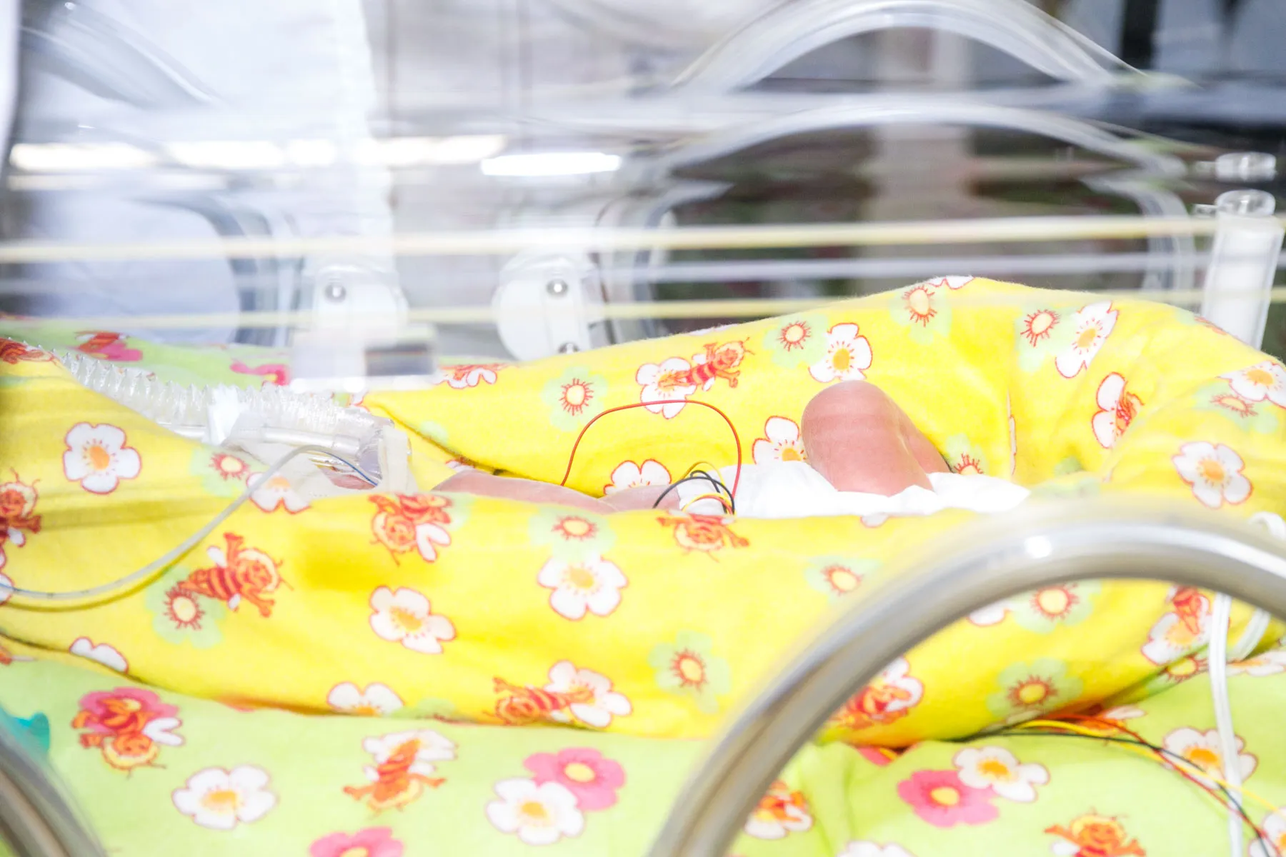 Gimdymas, kūdikis, inkubatorius, akušerijos ligoninė