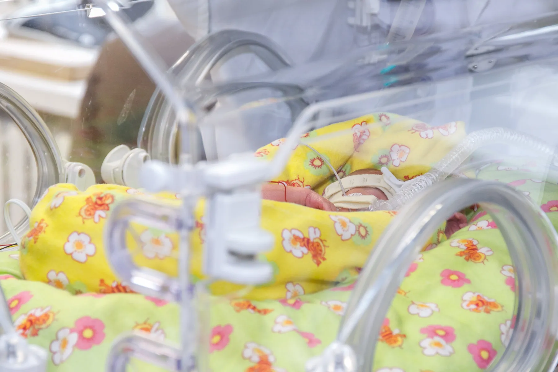 Gimdymas, kūdikis, inkubatorius, akušerijos ligoninė