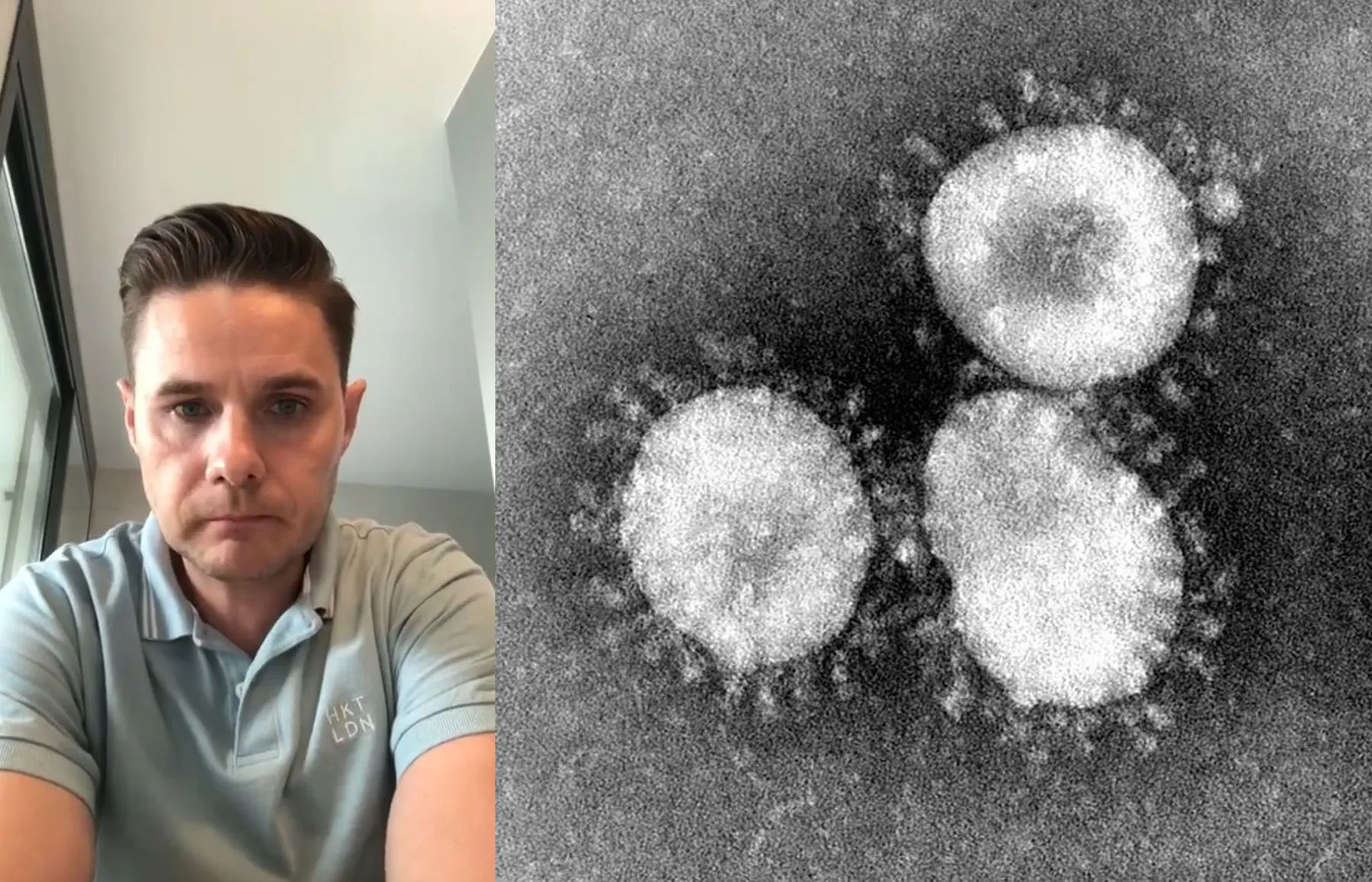 Mindaugas Gudelis, koronavirusas