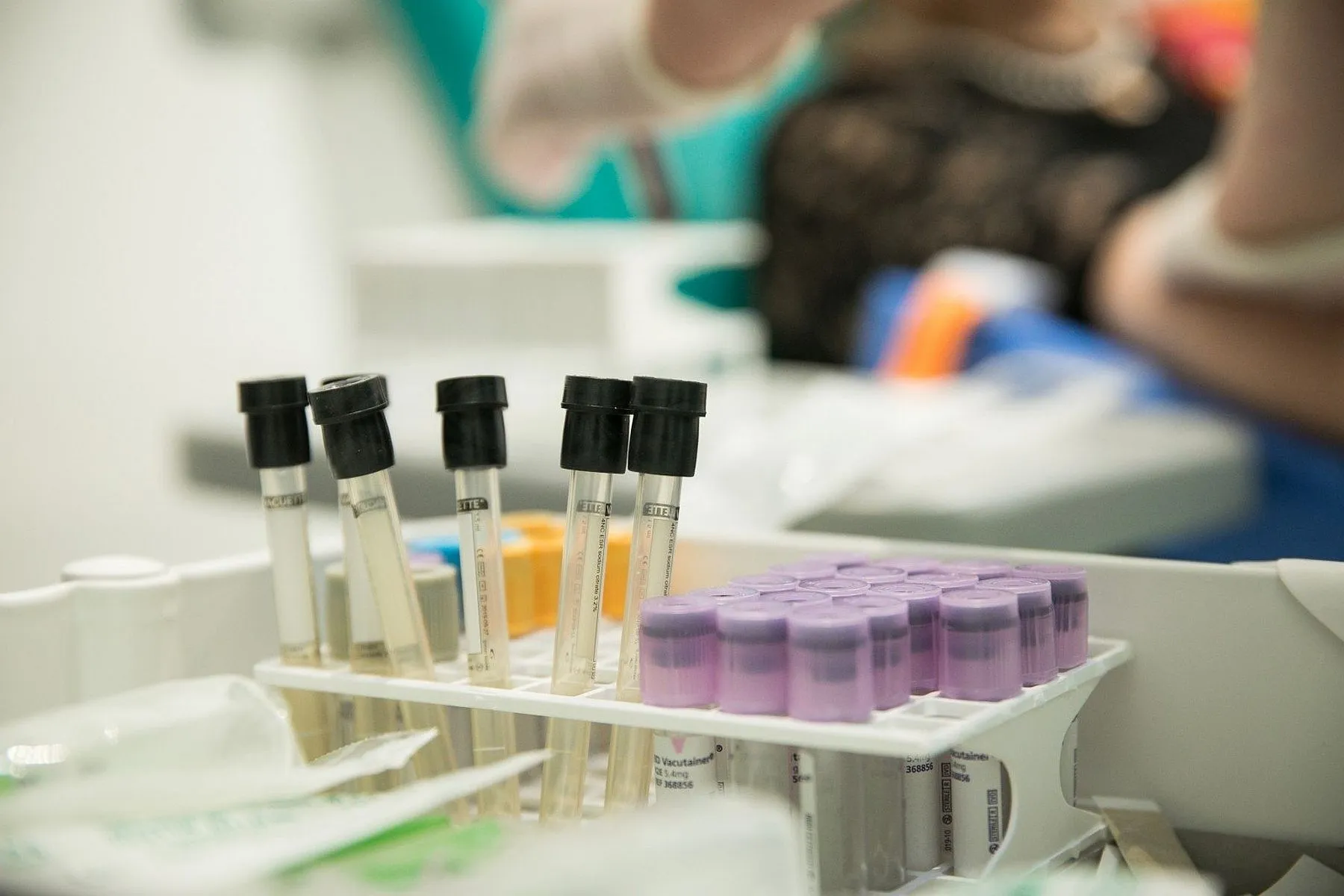 Tyrimas mėginiai tyrimai, koronavirusas