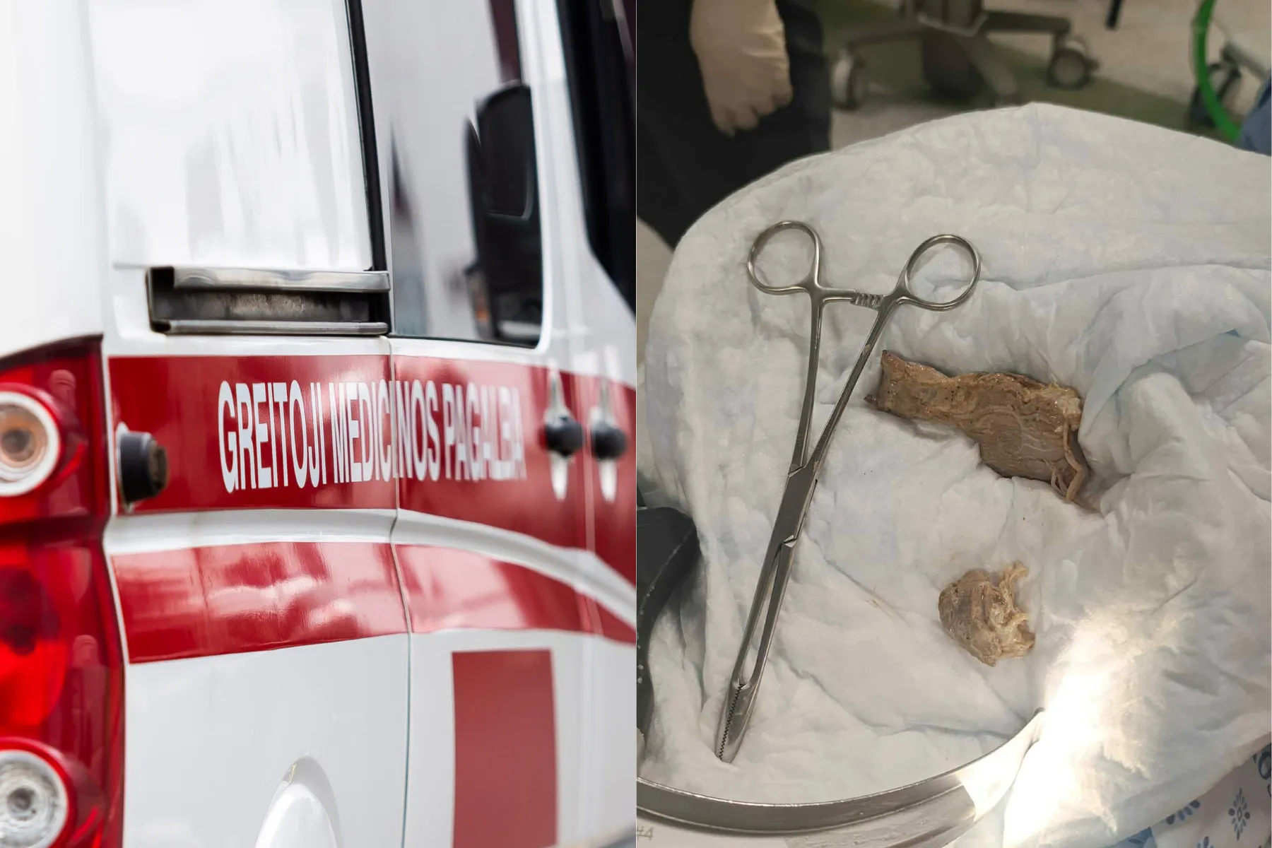 Iš kvėpavimo takų pašalintas kepsnio gabalas / Kauno klinikų skubios pagalbos skyriaus / D. Labučio / ELTA nuotr.