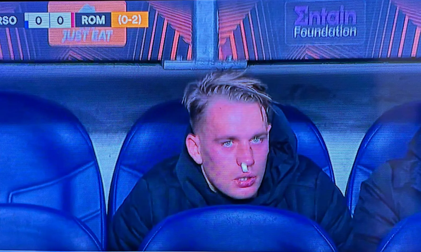 europa league real sociedad roma karsdorp infortunio