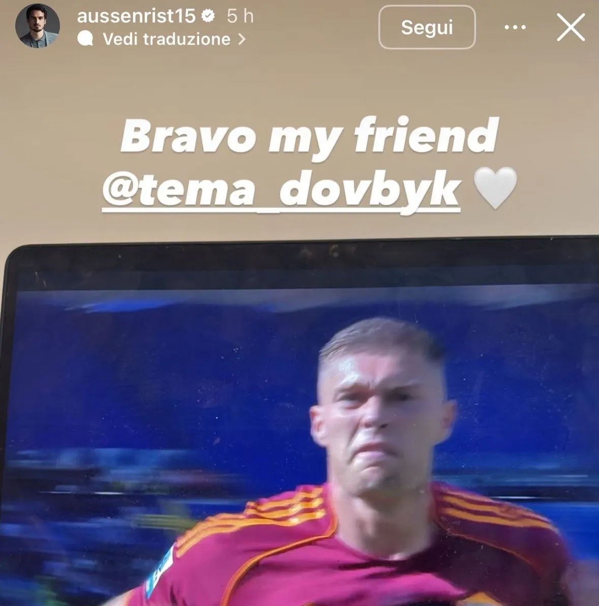hummels ig dovbyk