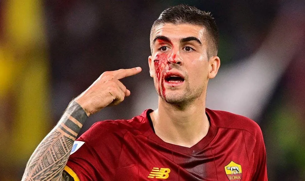 mancini sangue roma udinese 2 1