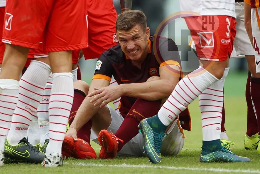 roma carpi dzeko infortunio 2