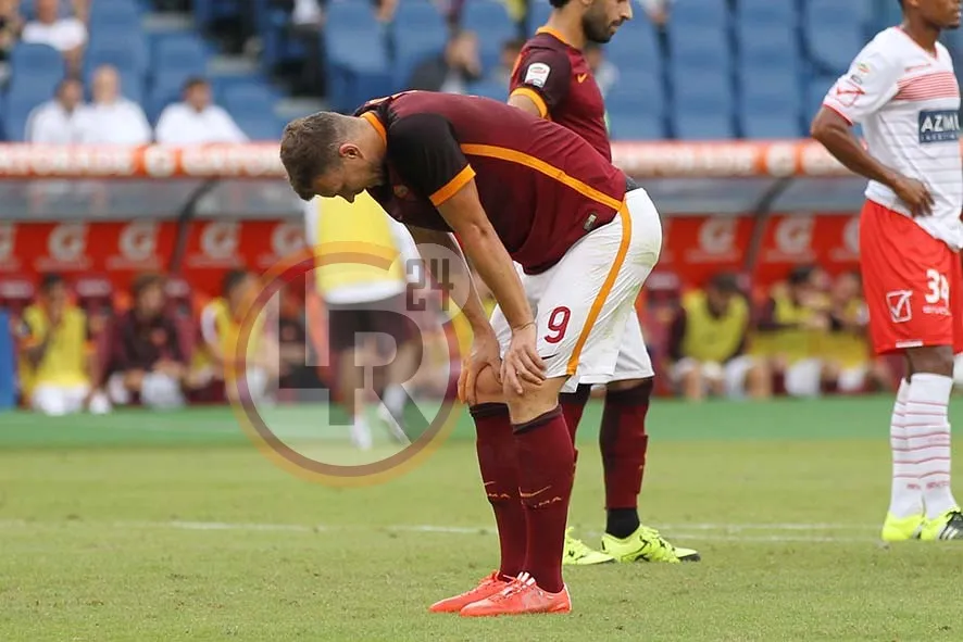 roma carpi dzeko infortunio