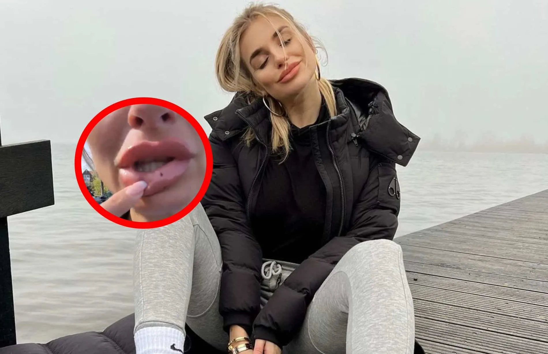 gaby blaaser vliegjes aan lippen