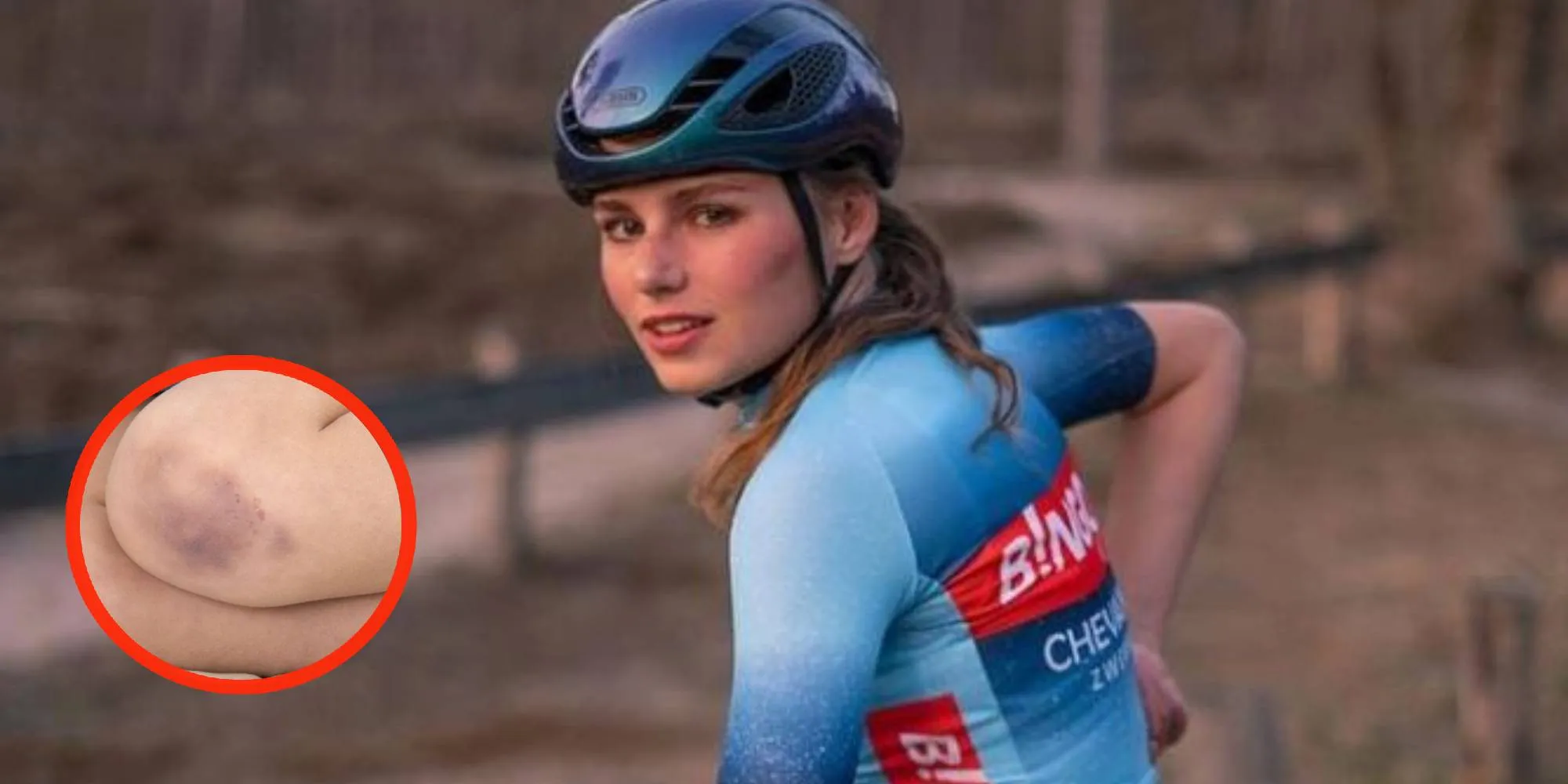 puck moonen blauwe plek foto