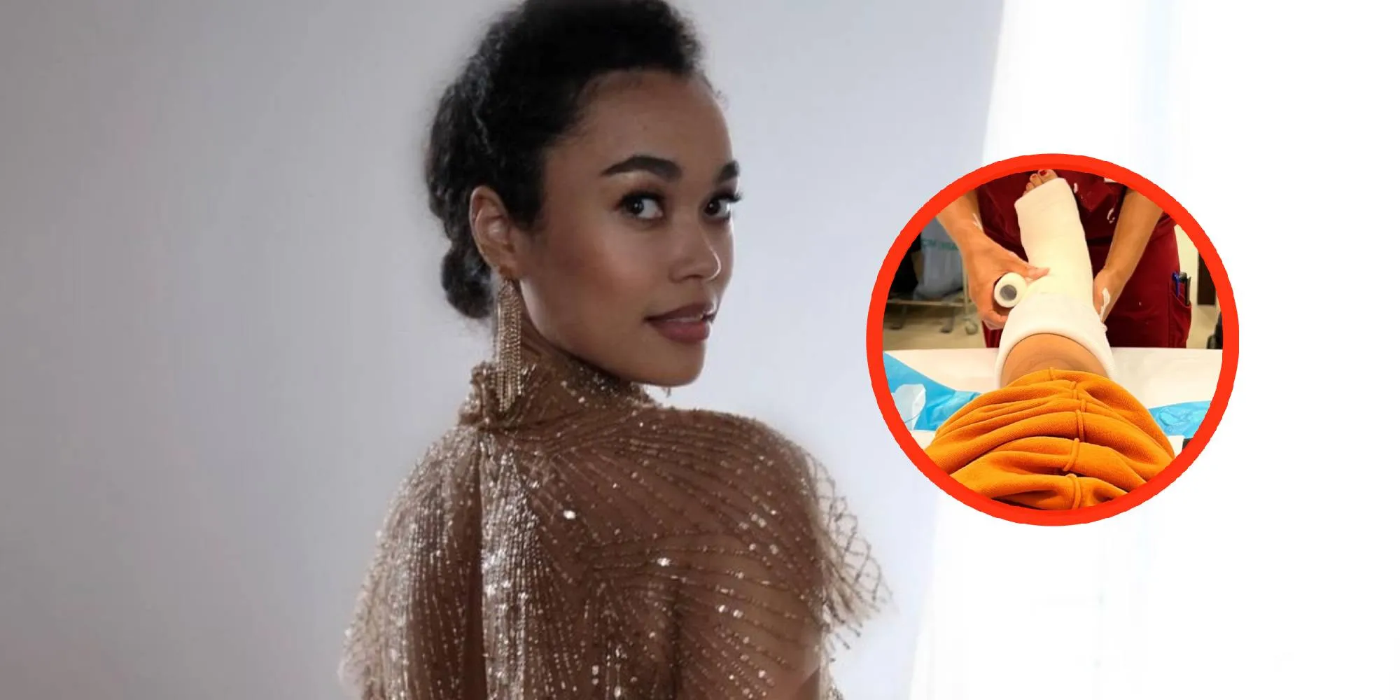romy monteiro been gips foto