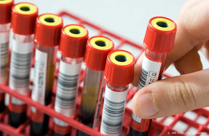 regels bloeddonatie homos in juli soepeler