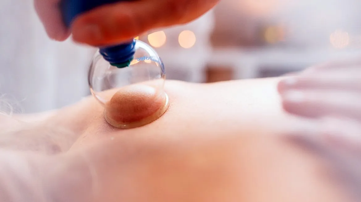 2016 04 25 cuppung therapie uit de drukte