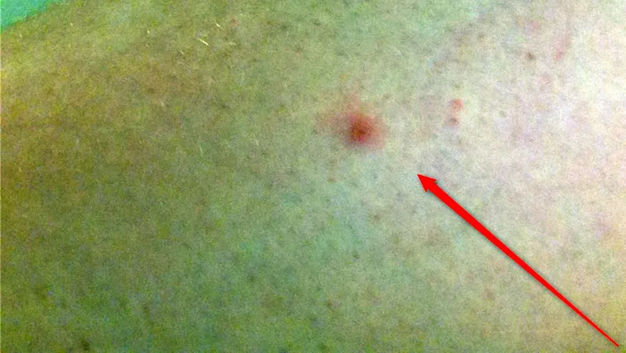 2016 07 01 tekenbeet