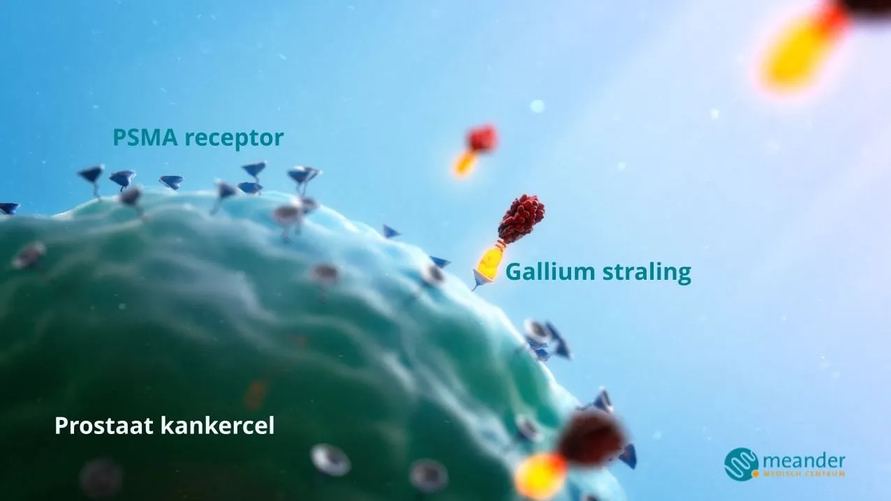 2016 10 03 meander opsporen prostaatkanker 010 plaat membraam 004