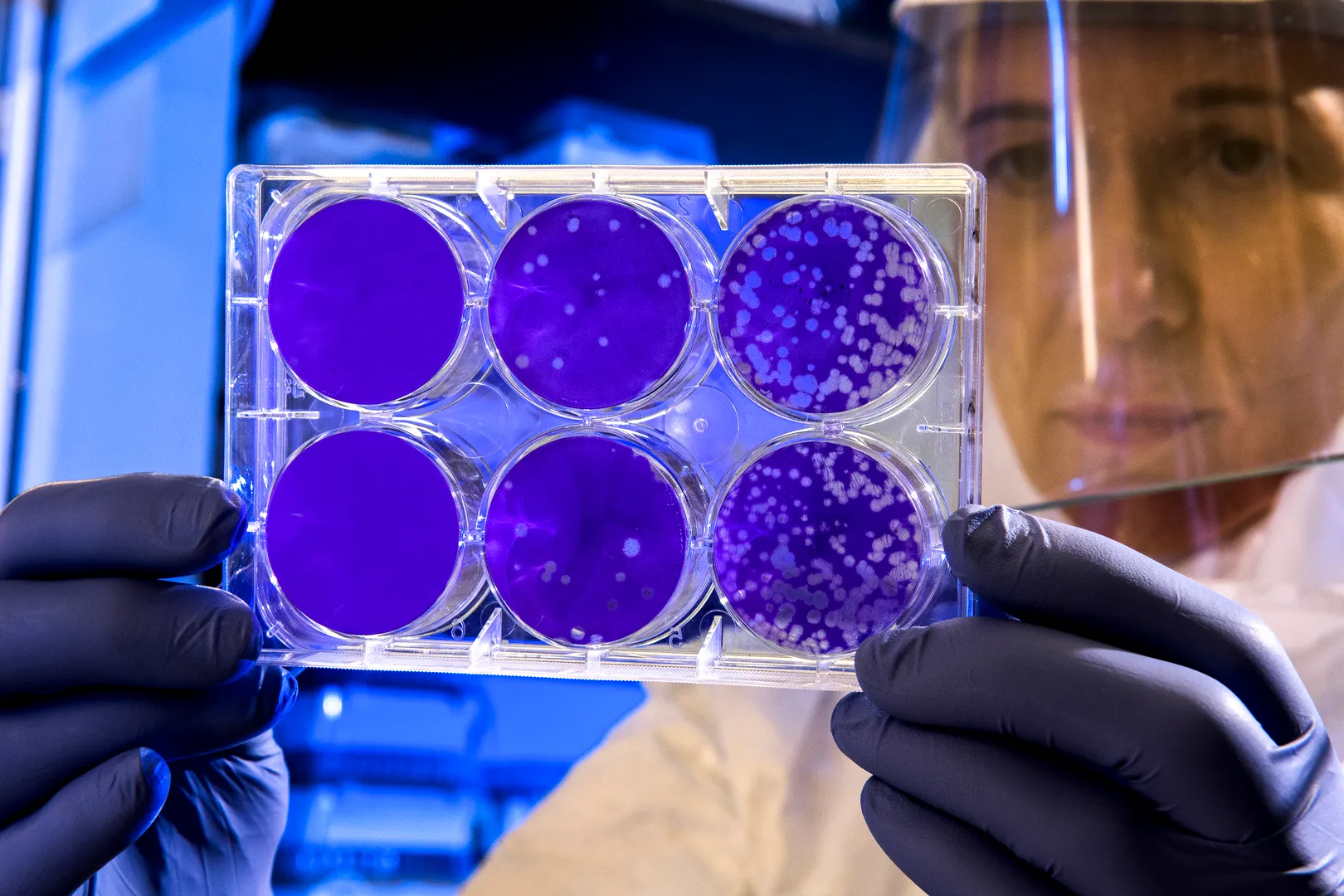 covid 19 coronavirus covid cell pandemic corona virus 1608795 pxherecom